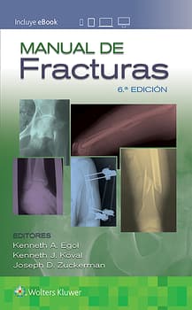 Manual de fracturas 6ª ed