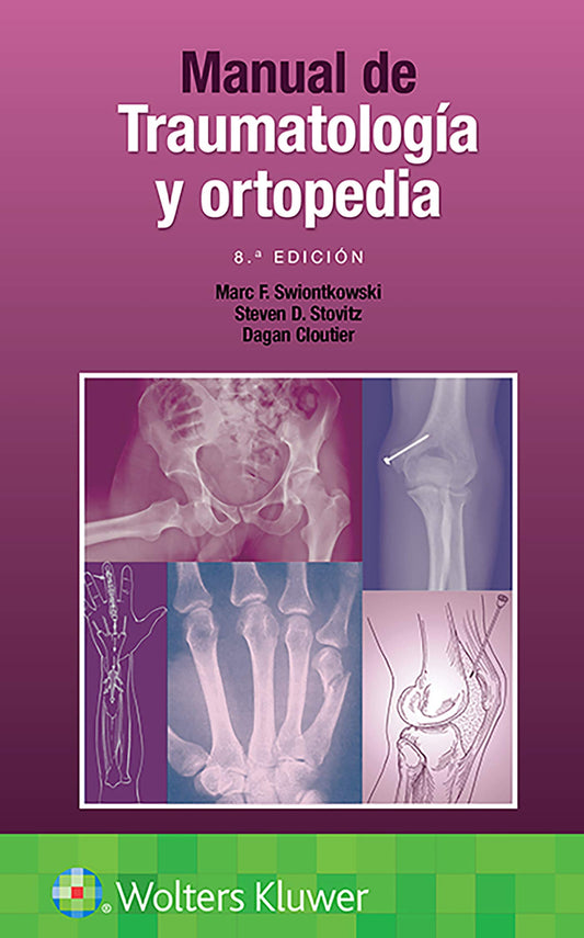 Manual de traumatología y ortopedia  8ª ed
