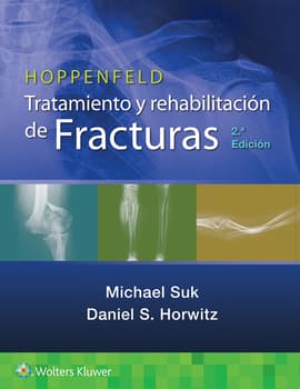 Hoppenfeld. Tratamiento y rehabilitación de fracturas  2ª ed